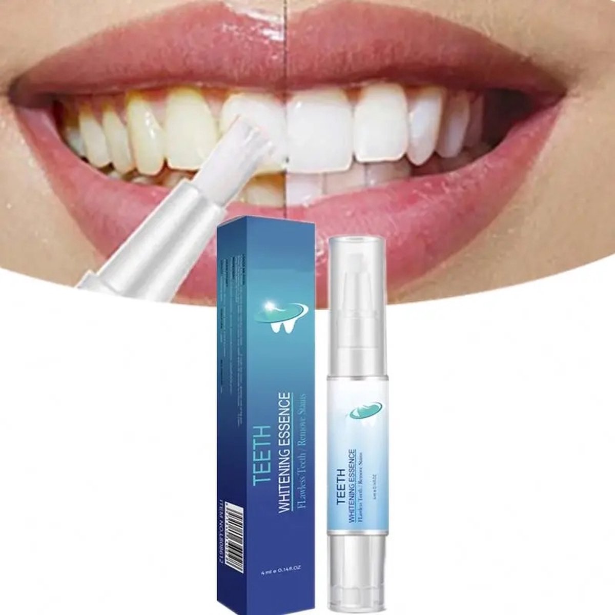 Goedkoopste Chicnest Tandenbleek Pen - Whitening Strips - Tandenbleekset - Whitening Pen - Tandenblekers - Wittere Tanden - Teeth Whitening Pen - Tanden Bleker
