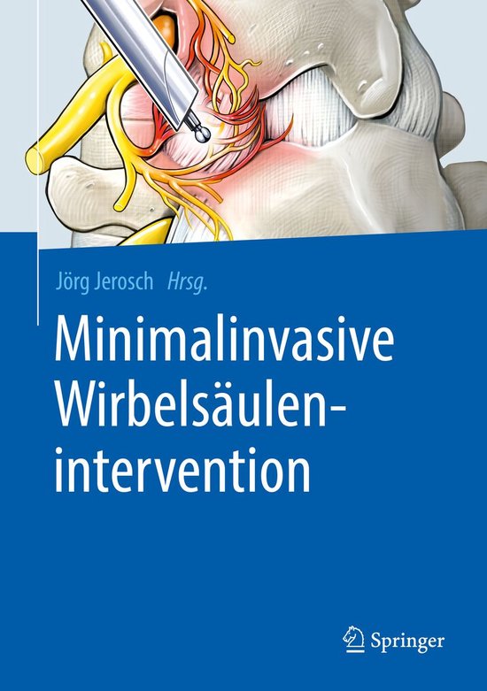 Minimalinvasive Wirbelsäulenintervention - cover