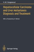Hepatocellular Carcinoma and Liver Metastases