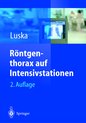 Rontgenthorax Auf Intensivstationen