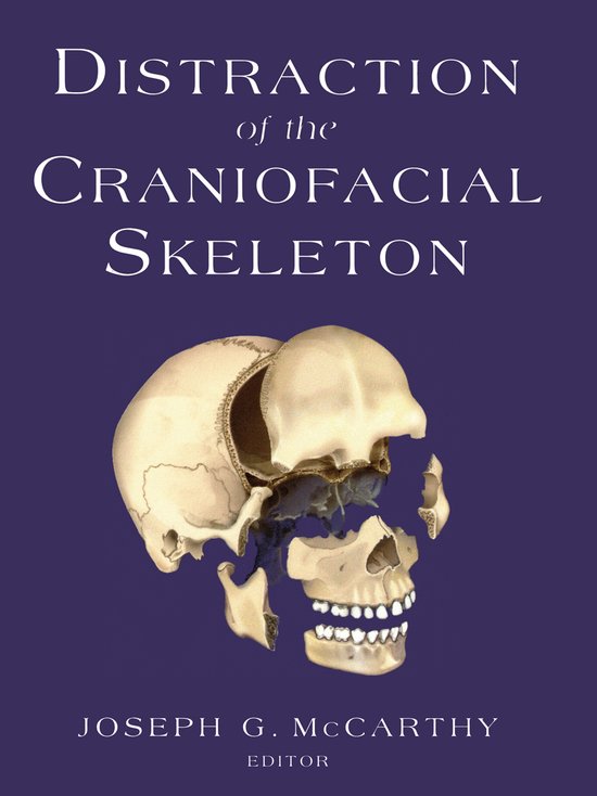 Distraction of the Craniofacial Skeleton - cover