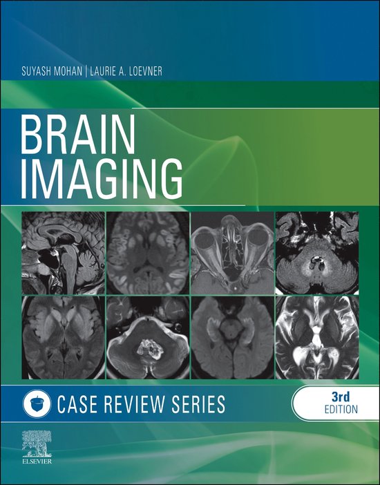 Brain Imaging - cover