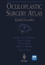 Oculoplastic Surgery Atlas