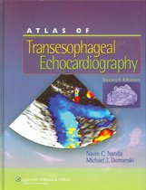 Atlas Of Transesophageal Echocardiography