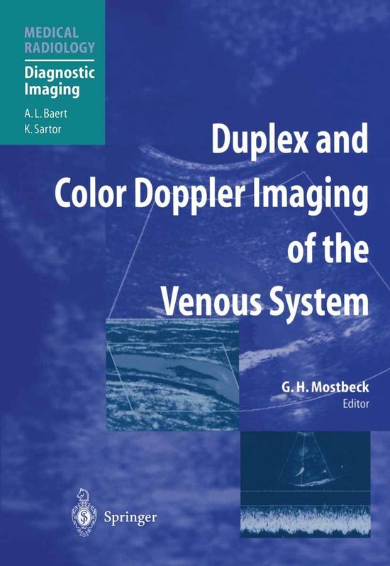 Foto: Medical radiology duplex and color doppler imaging of the venous system