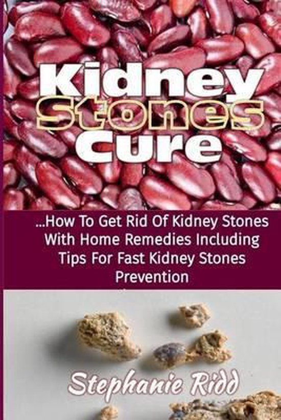 Kidney Stones Cure, Stephanie Ridd 9781533111432 Boeken
