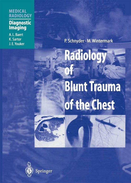 Medicine (R0) - Radiology of Blunt Trauma of the Chest - cover