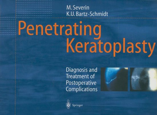 Penetrating Keratoplasty - cover