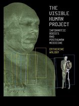 The Visible Human Project