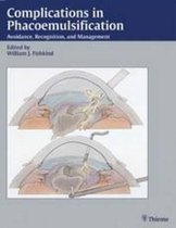 Complications in Phacoemulsification