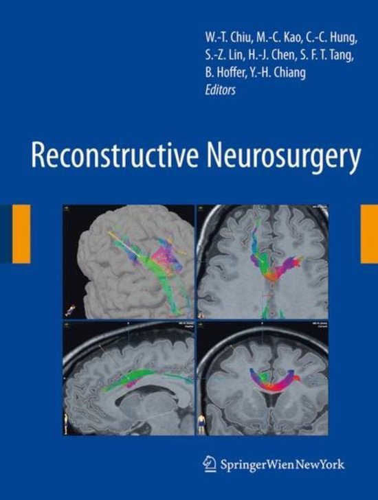 Reconstructive Neurosurgery - cover
