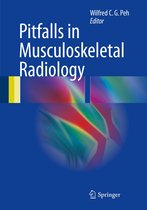 Pitfalls in Musculoskeletal Radiology