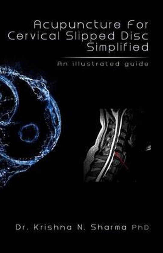Acupuncture for Cervical Slipped Disc Simplified, Dr Krishna N Sharma