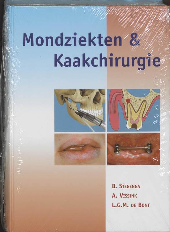 Cover van het boek 'Mondziekten en kaakchirurgie / druk 1'