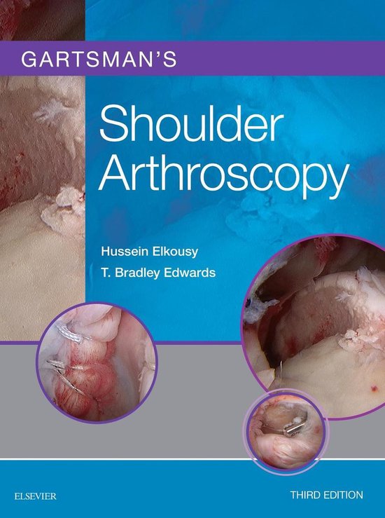 Gartsman's Shoulder Arthroscopy E-Book - cover