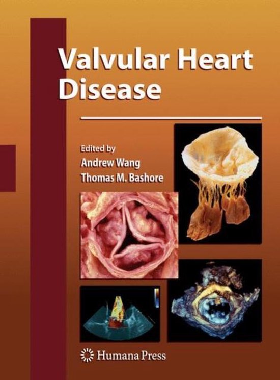 Valvular Heart Disease - cover