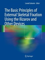 The Basic Principles of External Skeletal Fixation Using the Ilizarov and Other