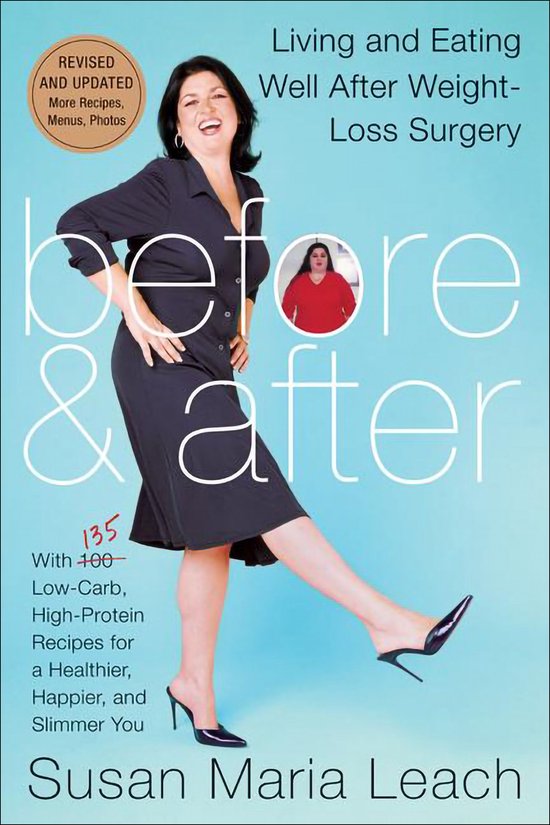 Before & After, Revised Edition - cover