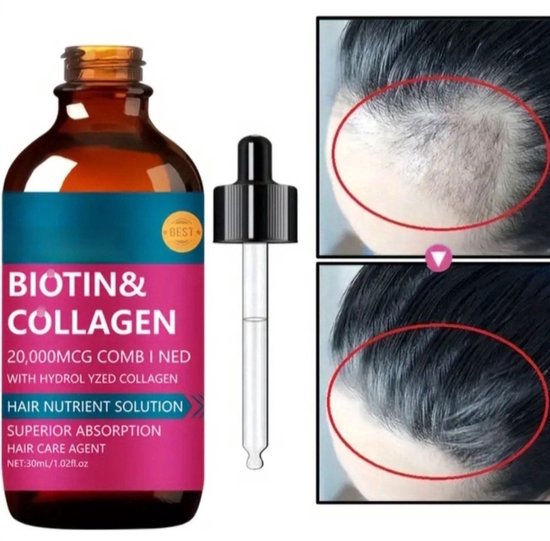 Zeer effectieve 100% gegarandeerd goed werkende haar biotin. helpt nieuwe haargroei aan te maken en te versterken 30ml