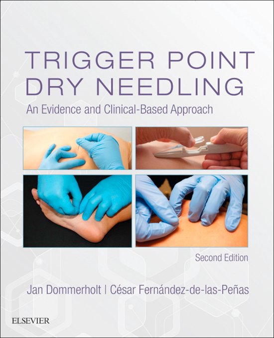 Trigger Point Dry Needling E-Book - cover