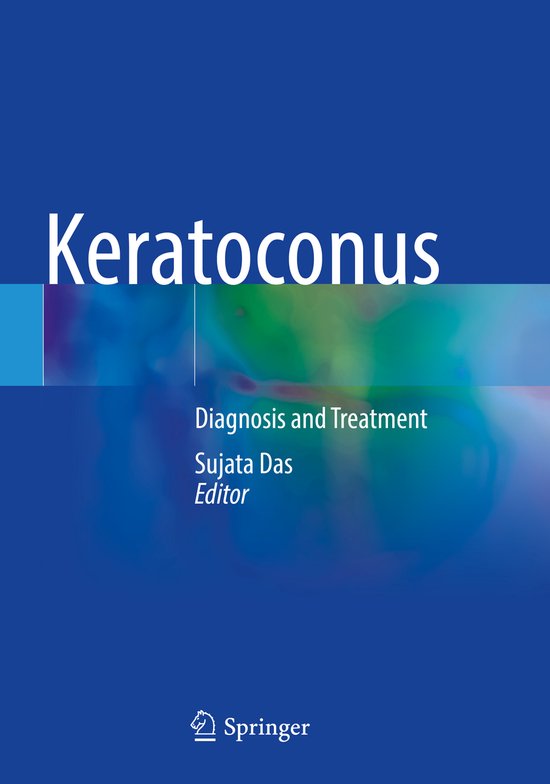 Keratoconus 9789811942648 Boeken