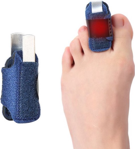 Teenbrace - Teenspalk voor kleine teen - Teen corrector - Vinger spalk ...