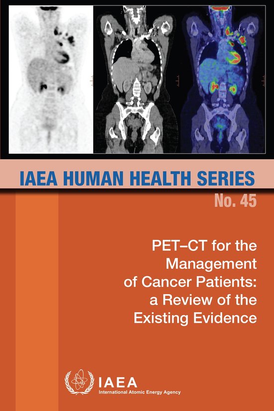 IAEA Human Health Series 45 - PET-CT for the Management of Cancer ...