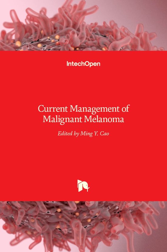 Current Management of Malignant Melanoma | 9789533072647 | MING YU CAO ...