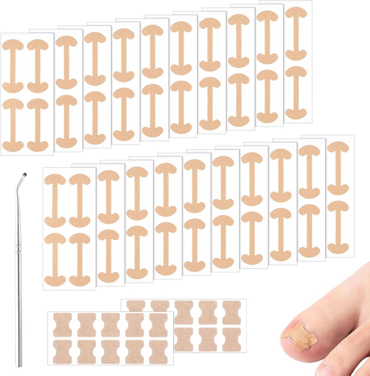 Set voor het corrigeren van ingegroeide teennagels, 100 stuks + 1 lifttool, pijnloos en eenvoudig in gebruik