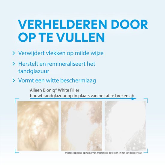 Microscopische opnames van tandglazuur met defecten die worden opgevuld. "Verhelderen door op te vullen".