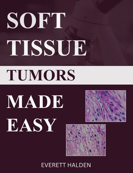 Soft Tissue Tumors Made Easy - cover