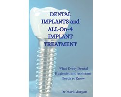 Dental Implants and All-On-4 Implant Treatment
