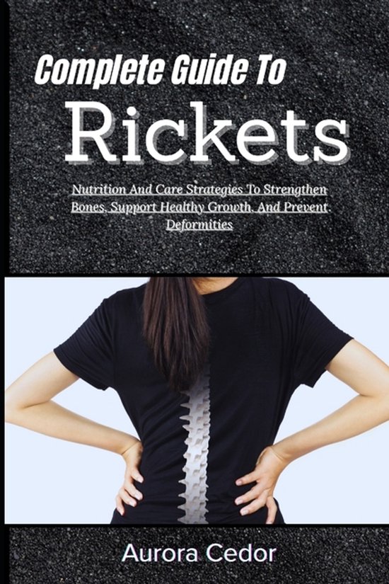 Complete Guide To Rickets - cover