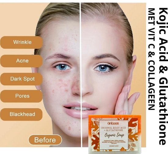 glutathione huid bleken Gsh Supplement Verhelderende Witte Gummies Aardbei Smaak Collageen Anti Veroudering L-Glutathion Gummies Origeen Kojic Acid Zeep -