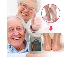EeltVerwijderaar-VoetenMasker Peeling- Eeltsokken Voetenmasker - CareFoot -Peel Mask- Baby Soft Feet-Heerlijk Zachte Voeten-2 stuks