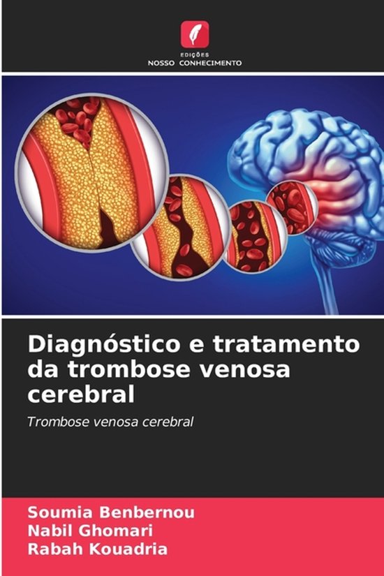 Couverture de livre : "Diagnóstico e tratamento da trombose venosa cerebral" avec illustration d'un cerveau et d'obstructions vasculaires.