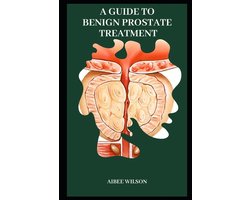 A Guide to Benign Prostate Treatment