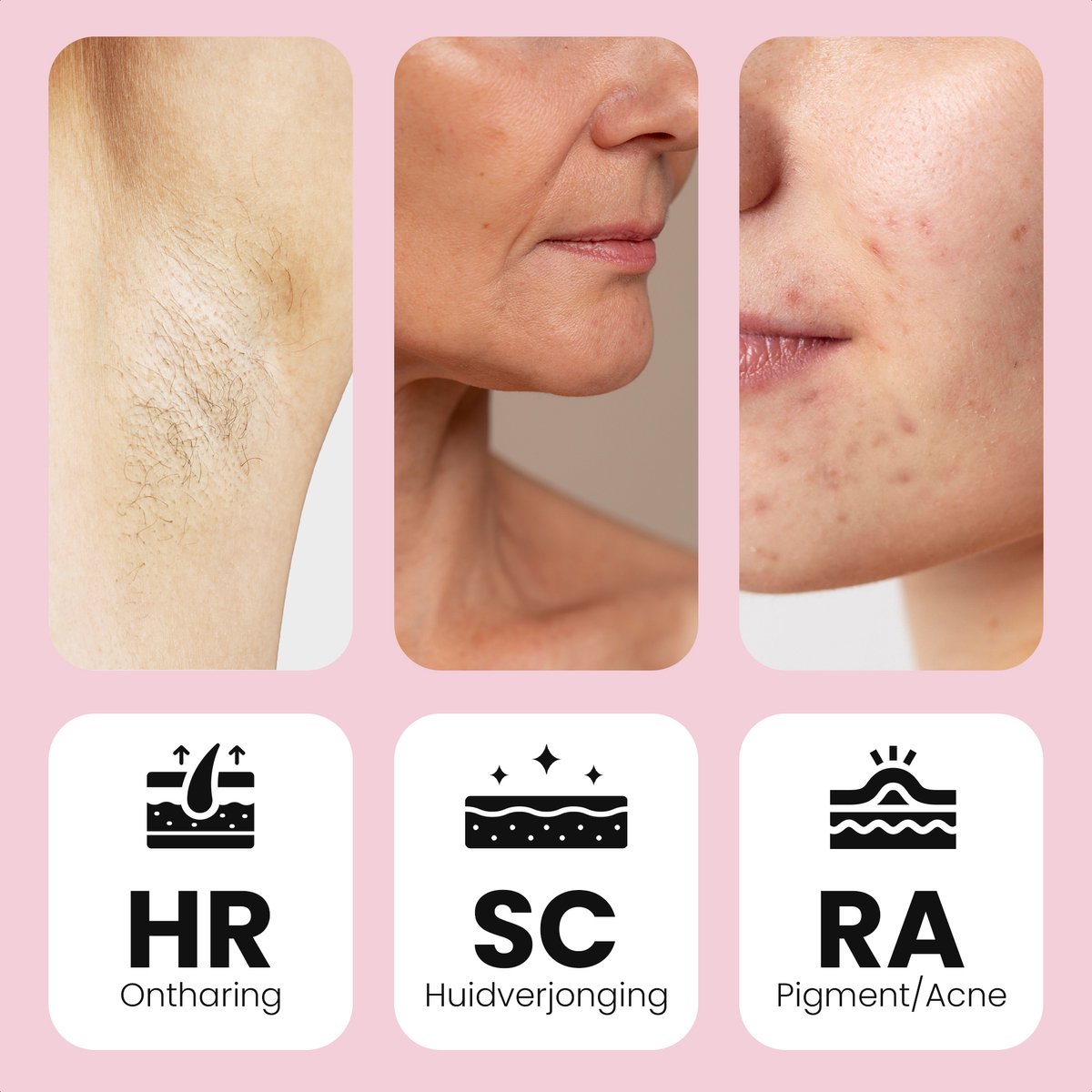 Leafline IPL Laser Ontharingsapparaat thumbnail 4