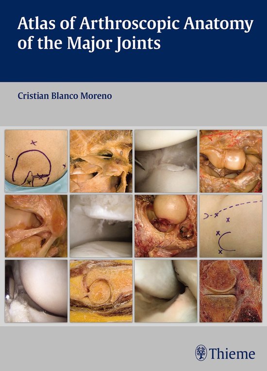 Atlas of Arthroscopic Anatomy of the Major Joints - cover
