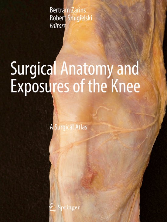 Surgical Anatomy and Exposures of the Knee - cover