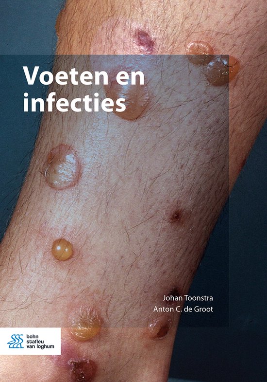 Voeten en infecties - cover