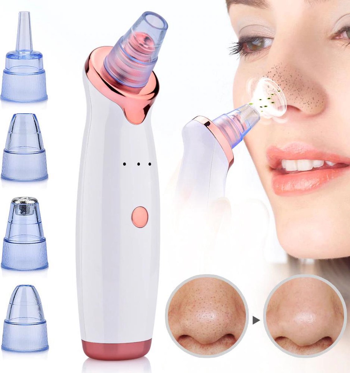 at home blackhead extractor