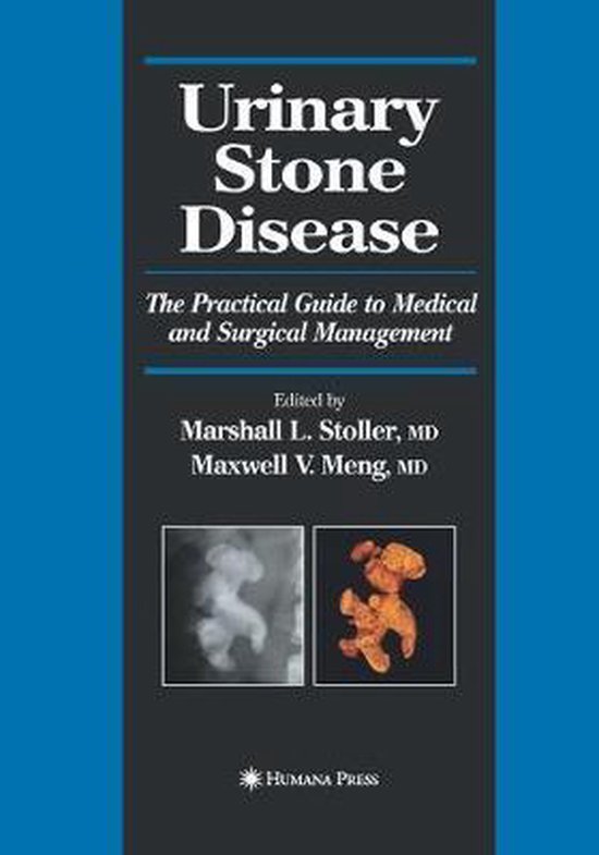 Current Clinical Urology- Urinary Stone Disease - cover