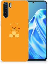 Silicone Hoesje OPPO A91 GSM Hoesje Baby Beer