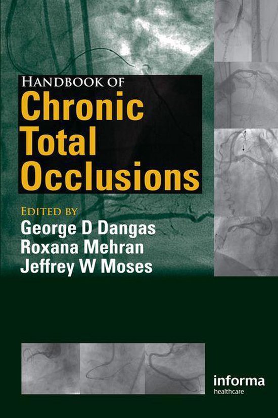 Handbook of Chronic Total Occlusions - cover