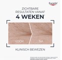 Vergelijking van huidtextuur voor en na gebruik met Eucerin Hyaluron-Filler + Longevity nachtcrème. Tekst: 'ZICHTBARE RESULTATEN VANAF 4 WEKEN', 'VOOR', 'NA', 'KLINISCH BEWEZEN'.