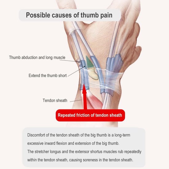 Duimspalk Duim Ondersteuning Polsbrace Voor Duim Pols Stabilisator Duimbeschermer Verstelbare Handbrace Links en Rechts Draagbaar One Size — afbeelding 4