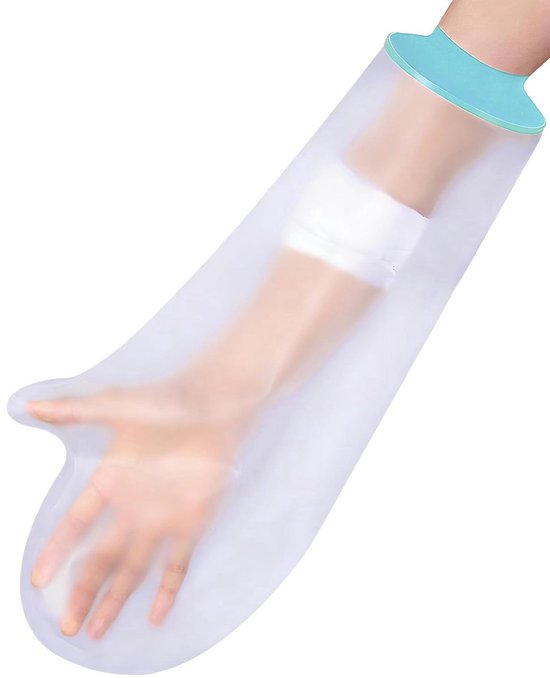 Een plastic douchehoes voor een halve arm met blauwe rand, gedrapeerd over een arm met een verband.
