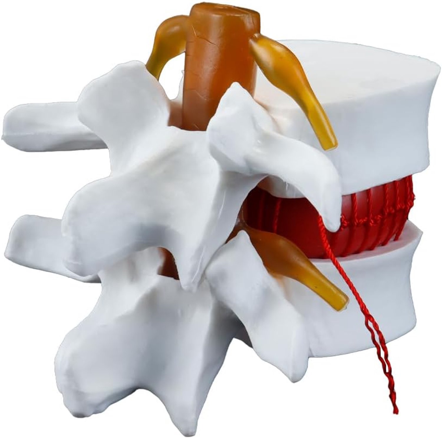 Anatomisch lumbale wervelmodel - 1,5x menselijk lumbale hernia demonstratiemodel Hernia (wit)