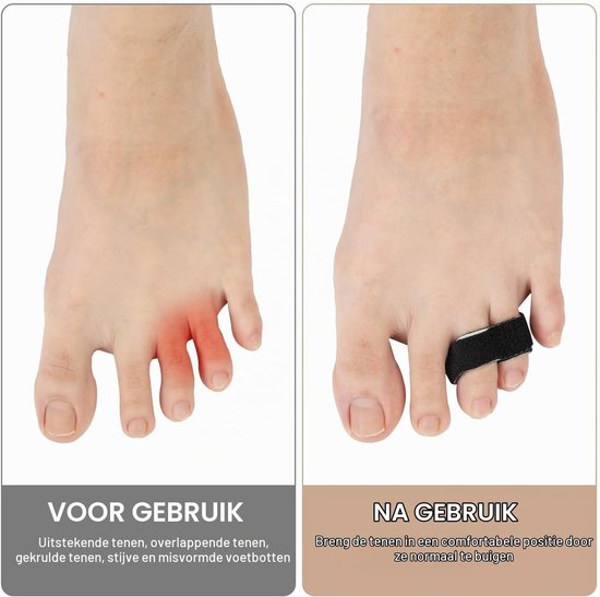 10 Stuks Vinger- en Teenverbanden, Buddy Tape voor Vingers, Bescherming en Ondersteuning voor Blessures en Verstuikingen — afbeelding 3